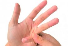 ¿Tronarse los dedos es malo? Aquí te contamos todo sobre eso ¿Tronarse los dedos es malo? Aquí te contamos todo sobre eso