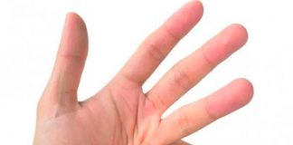 ¿Tronarse los dedos es malo? Aquí te contamos todo sobre eso