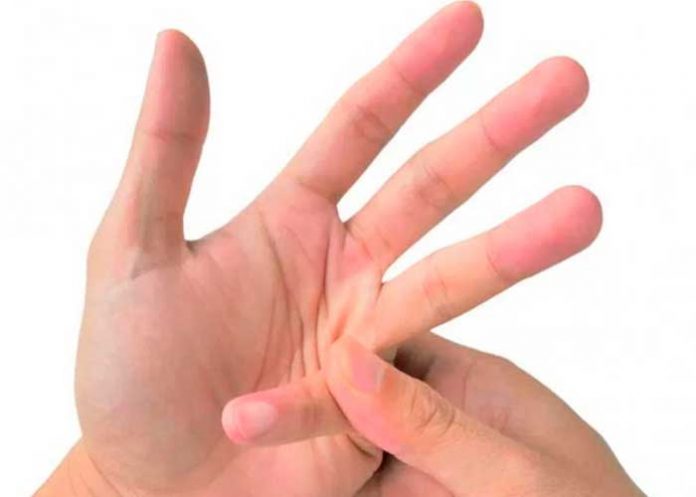 ¿Tronarse los dedos es malo? Aquí te contamos todo sobre eso