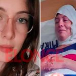 Joven fue quemada con aceite hirviendo por cobrar dinero a su expareja Joven fue quemada con aceite hirviendo por cobrar dinero a su expareja