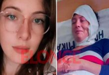 Joven fue quemada con aceite hirviendo por cobrar dinero a su expareja