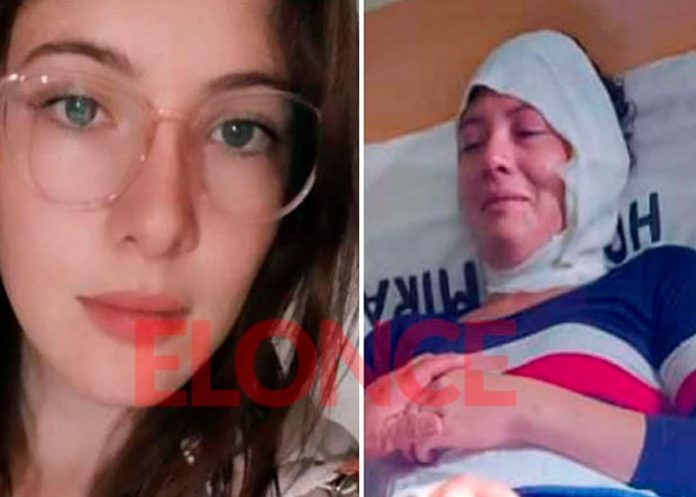 Joven fue quemada con aceite hirviendo por cobrar dinero a su expareja