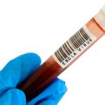 Registran nuevo caso de fiebre hemorrágica del Ébola en República del Congo Registran nuevo caso de fiebre hemorrágica del Ébola en República del Congo