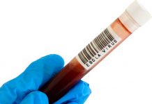 Registran nuevo caso de fiebre hemorrágica del Ébola en República del Congo Registran nuevo caso de fiebre hemorrágica del Ébola en República del Congo
