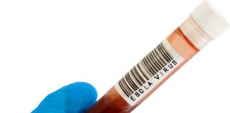 Registran nuevo caso de fiebre hemorrágica del Ébola en República del Congo