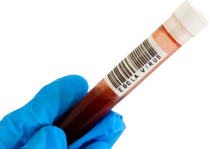 Registran nuevo caso de fiebre hemorrágica del Ébola en República del Congo