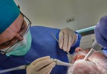 Va al dentista e inhala por accidente pieza de taladro, Estados Unidos Va al dentista e inhala por accidente pieza de taladro, Estados Unidos