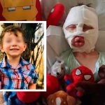 Niño es quemado intencionalmente por otro mientras jugaban en Estados Unidos Niño es quemado intencionalmente por otro mientras jugaban en Estados Unidos