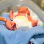 Nació niño con dos penes en Brasil