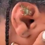 El surrealista momento en que un cangrejo sale del oído de una joven