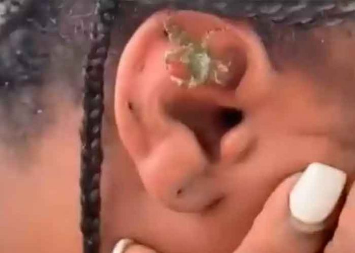 El surrealista momento en que un cangrejo sale del oído de una joven
