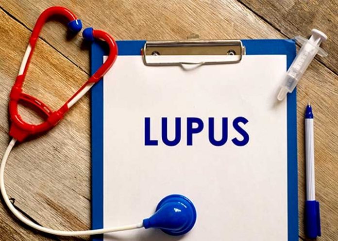 salud3 ¡Esperanza en nuevos tratamientos! Descubren una causa genética del lupus