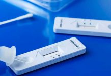 Científicos desarrollan test de orina para detectar COVID-19.