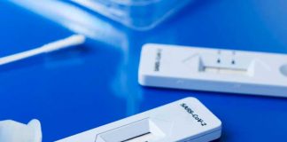 Científicos desarrollan test de orina para detectar COVID-19.