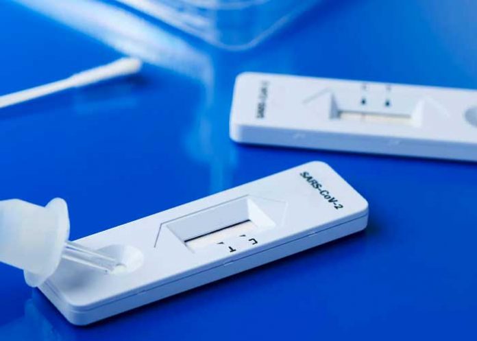 Científicos desarrollan test de orina para detectar COVID-19.