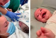 Bebé australiana nace con síndrome de «sonrisa permanente» Bebé australiana nace con síndrome de "sonrisa permanente"