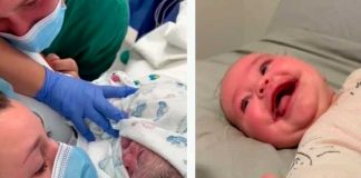 Bebé australiana nace con síndrome de "sonrisa permanente"