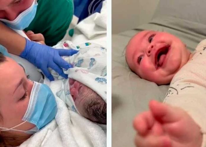 Bebé australiana nace con síndrome de 