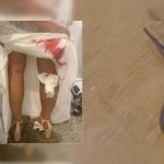 Australia: Sanguijuelas casi arruinan la boda de una mujer Australia: Sanguijuelas casi arruinan la boda de una mujer