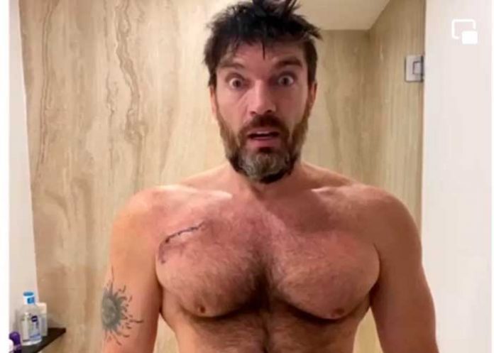 .2 El actor Julián Gil confiesa que enfrenta una batalla contra el cáncer