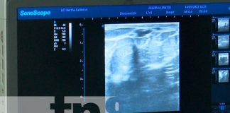 Nicaragua: Con ultrasonidos anticipados podrás detectar el cáncer de mamas