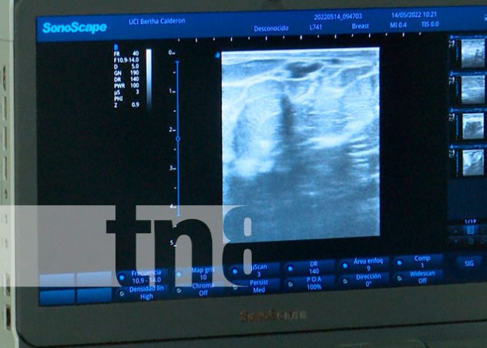 Nicaragua: Con ultrasonidos anticipados podrás detectar el cáncer de mamas