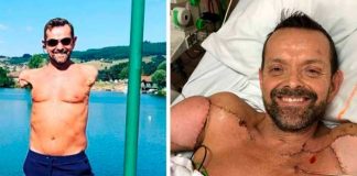 Recibe un trasplante de brazos y al fin puede abrazar a su familia
