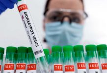 Panamá declara alerta sanitaria por viruela del mono Panamá declara alerta sanitaria por viruela del mono