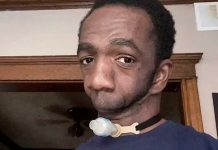 Encontró el verdadero amor: Hombre sin mandíbula celebró su boda Encontró el verdadero amor: Hombre sin mandíbula celebró su boda