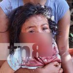 Perros Pitbull desfiguran rostro de una niña en Chichigalpa, Chinandega Pitbull ataca a una niña en Chichigalpa, Chinandega