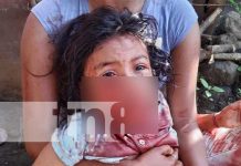 Perros Pitbull desfiguran rostro de una niña en Chichigalpa, Chinandega Pitbull ataca a una niña en Chichigalpa, Chinandega