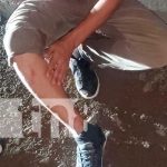 Chontales: Conductor se da a la fuga tras atropellar peatón en Juigalpa