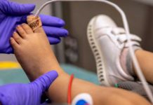 Autoridades confirma cuatro muertes por hepatitis infantil en Indonesia