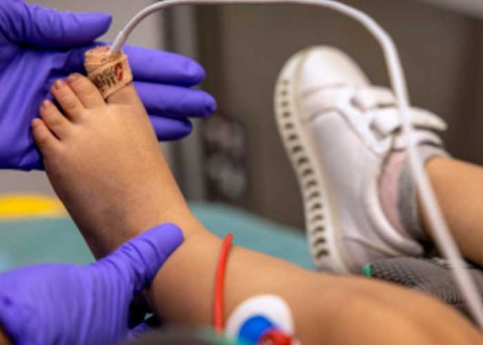 Autoridades confirma cuatro muertes por hepatitis infantil en Indonesia