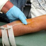 Ciudadanos de Suiza potenciales donantes de órganos