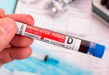 Cuatro casos sospechosos de hepatitis aguda en niños reportan en Portugal