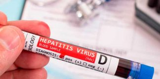 Cuatro casos sospechosos de hepatitis aguda en niños reportan en Portugal