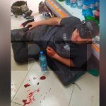 Durante su labor, ataques ucranianos hieren a camarógrafos de RT Durante su labor, ataques ucranianos hieren a camarógrafos de RT