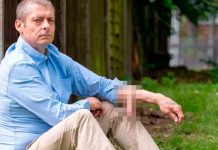¡Extraño caso! Hombre pasó 6 años con la «cola» colgando de su brazo ¡Extraño caso! Hombre pasó 6 años con la "cola" colgando de su brazo