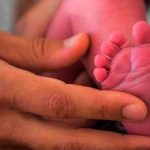 Médicos separan a gemelos siameses «unidos por distintos órganos» Gemelos separados por 24 médicos en Yemen