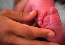 Gemelos separados por 24 médicos en Yemen