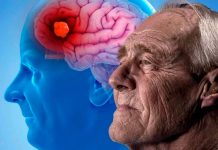 ¡Al fin! Alzheimer ya se puede detectar a tiempo con uso de escáner ¡Al fin! Alzheimer ya se puede detectar a tiempo con uso de escáner
