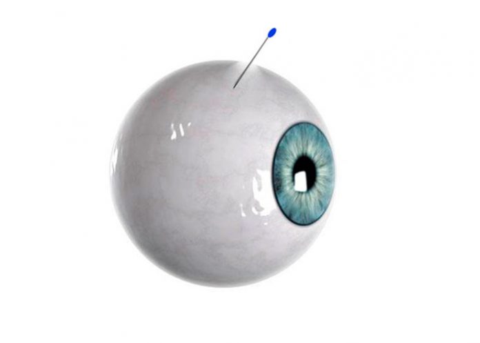 Científicos crean microaguja para evitar infecciones oculares