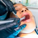 Alimentos que puedes ingerir luego de una extracción de diente