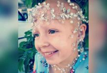 «Día del pelo loco»: Niña con alopecia gana concurso escolar "Día del pelo loco": Niña con alopecia gana concurso escolar