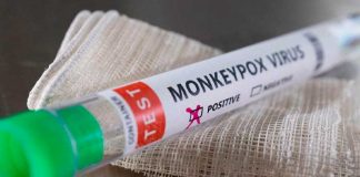 La OMS investiga si la viruela del mono se transmite mediante el semen