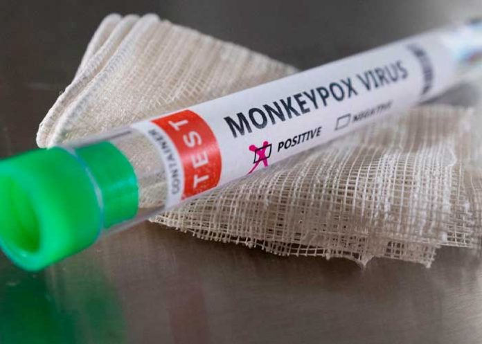 La OMS investiga si la viruela del mono se transmite mediante el semen