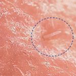 Ácaros: Animales que se pasean por tu rostro en las noches Ácaros: Animales que se pasean por tu rostro en las noches