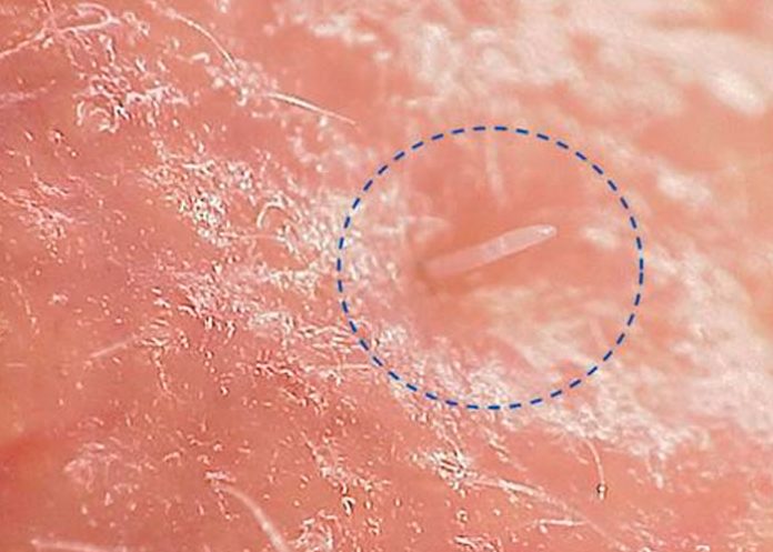 Ácaros: Animales que se pasean por tu rostro en las noches