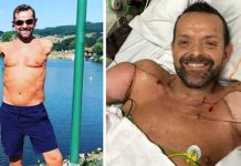 ‘Exitosa cirugía’ le devuelve los brazos a hombre, Francia 'Exitosa cirugía' le devuelve los brazos a hombre, Francia